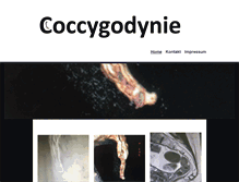 Tablet Screenshot of coccygodynie.de
